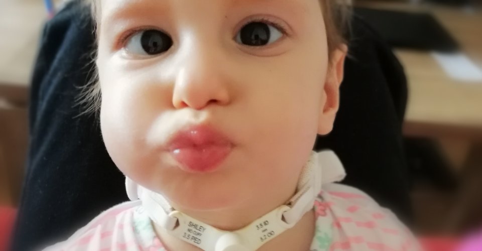Ninkin vývoj už v brušku naznačoval, že bude po narodení čeliť viacerým komplikáciám